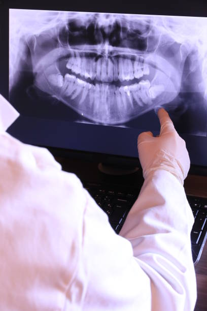 Best Emergency Tooth Extraction in Oak Island, NC