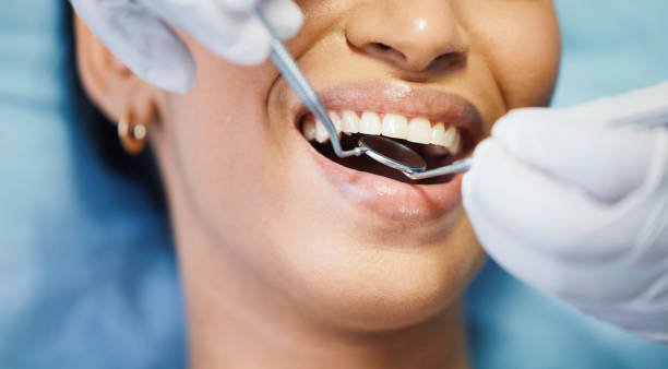 Best Same-Day Emergency Dental Services in Oak Island, NC