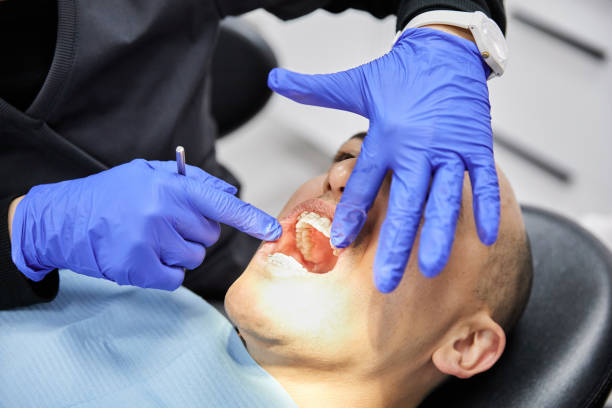 Best Emergency Denture Repair in Oak Island, NC