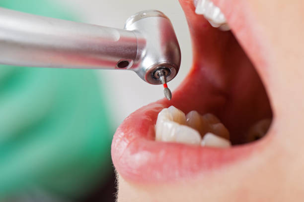 Best Weekend Emergency Dentist in Oak Island, NC
